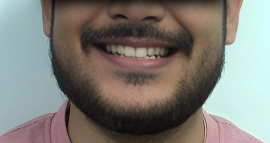 After