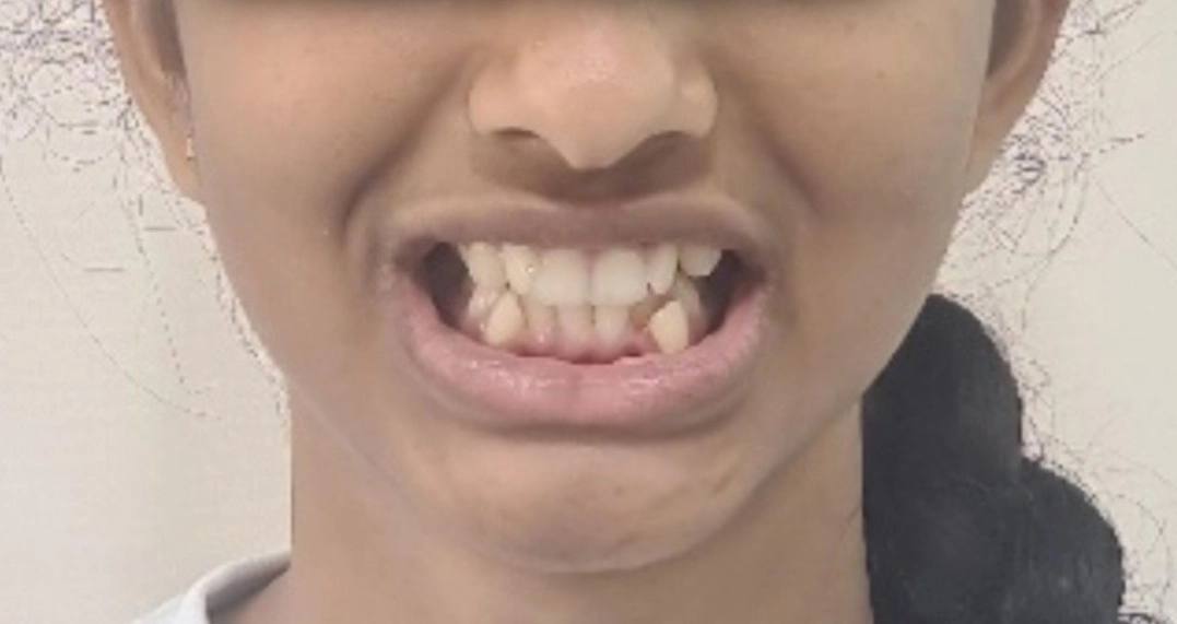 Before