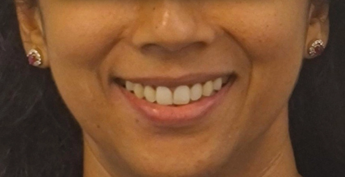 After
